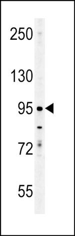 ENAM Antibody in Western Blot (WB)