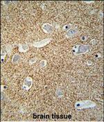 beta Synuclein Polyclonal Antibody