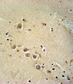 RASGRP1 Polyclonal Antibody