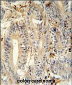 MEP1A Antibody in Immunohistochemistry (Paraffin) (IHC (P))