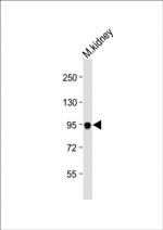 MEP1A Antibody in Western Blot (WB)