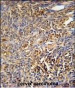 TANK Polyclonal Antibody