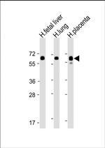 PPAR gamma Polyclonal Antibody