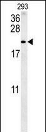 TAC1 C-terminal Peptide Polyclonal Antibody