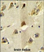 KCC2 Polyclonal Antibody
