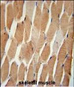 COQ7 Polyclonal Antibody