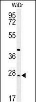 DIRAS3 Antibody in Western Blot (WB)