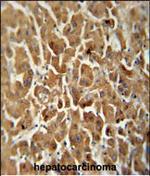 ATP5G2 Polyclonal Antibody