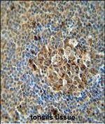 ACSF3 Polyclonal Antibody