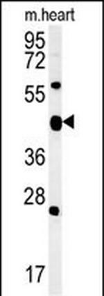 ACSF3 Antibody in Western Blot (WB)