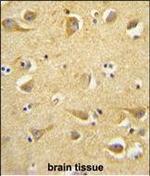 Clathrin Heavy Chain Polyclonal Antibody