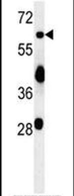 ZNF20 Antibody in Western Blot (WB)