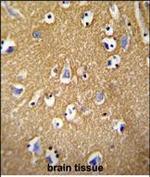 Brevican Antibody in Immunohistochemistry (Paraffin) (IHC (P))