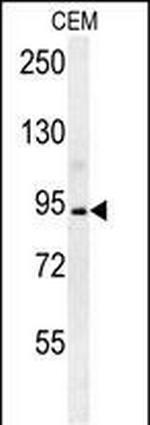 Brevican Antibody in Western Blot (WB)