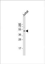 DDI2 Polyclonal Antibody