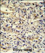 C1orf186 Polyclonal Antibody