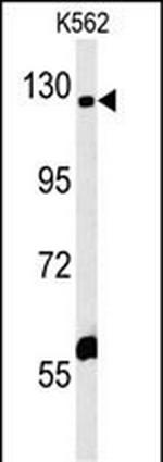 IQSEC3 Polyclonal Antibody
