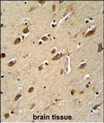 MYLK4 Polyclonal Antibody