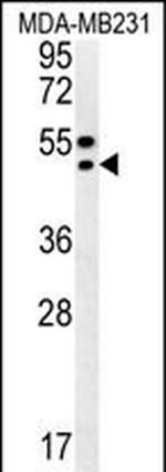 TRAM2 Antibody in Western Blot (WB)
