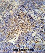 OTUD4 Polyclonal Antibody