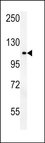OTUD4 Antibody in Western Blot (WB)