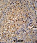 EB1 Polyclonal Antibody