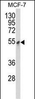 PDK3 Polyclonal Antibody