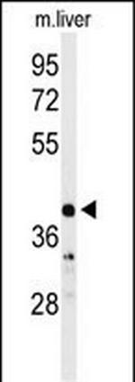 Carbonic Anhydrase VB Antibody in Western Blot (WB)