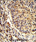 ADAM9 Polyclonal Antibody
