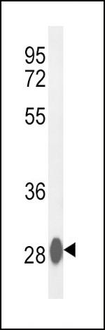Carbonic Anhydrase III Antibody in Western Blot (WB)