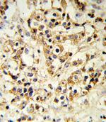 FGFR1 Polyclonal Antibody