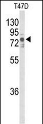 TNK1 Polyclonal Antibody