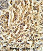 CYP21A2 Antibody in Immunohistochemistry (Paraffin) (IHC (P))