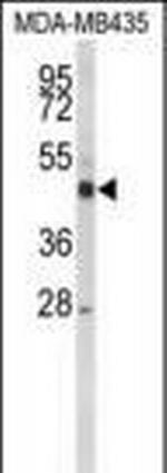 CYP21A2 Antibody in Western Blot (WB)