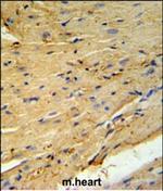 Phospholamban Polyclonal Antibody