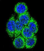 CYP3A43 Polyclonal Antibody