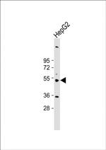 CYP3A43 Antibody in Western Blot (WB)