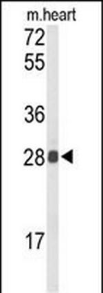 TSPAN1 Antibody in Western Blot (WB)