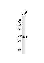 S6 Antibody in Western Blot (WB)