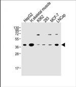 OR2H2 Polyclonal Antibody