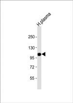 Complement Factor B Antibody in Western Blot (WB)