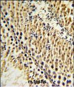 EXTL3 Polyclonal Antibody