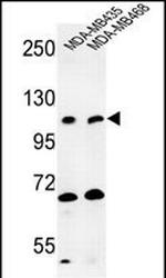 EXTL3 Antibody in Western Blot (WB)