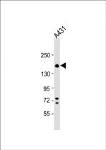 ITGA2 Polyclonal Antibody