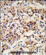 SPRR1B Polyclonal Antibody