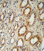 CYP27B1 Polyclonal Antibody