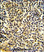BPI Polyclonal Antibody