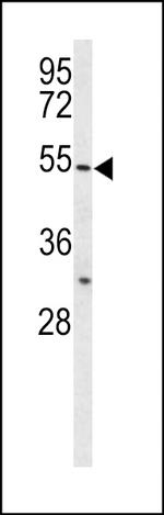BPI Antibody in Western Blot (WB)
