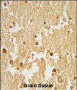 ESRRB Polyclonal Antibody