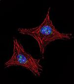 UTY Polyclonal Antibody